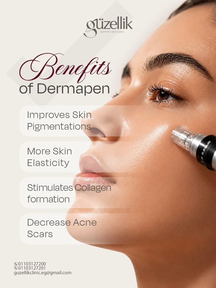 Dermapen at güzellik clinic